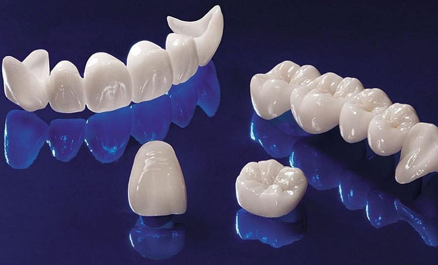 dental-center-cerkone-atamner-ivoclar