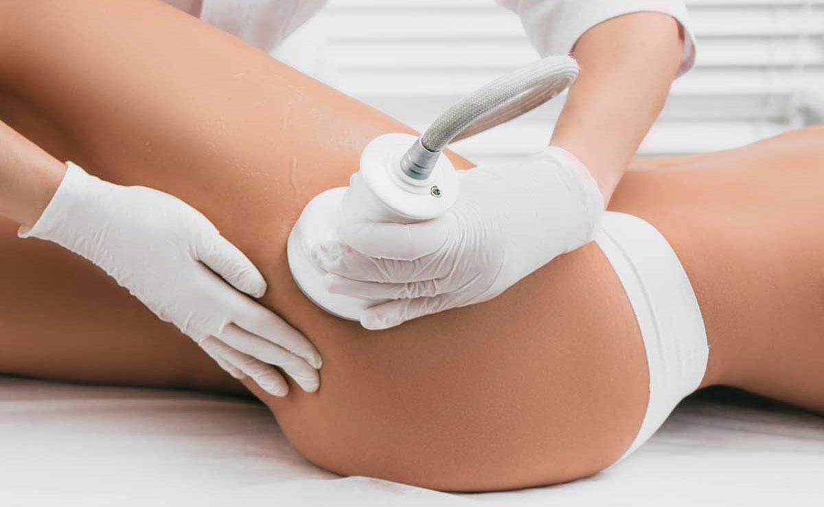 cavitation-mon-art-studio-yerevan