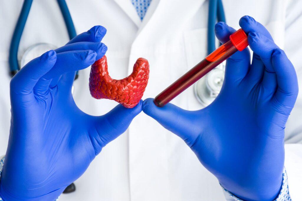 vahanadzev-gexdz-hotmon-sonografia-tm-diagnostic-center