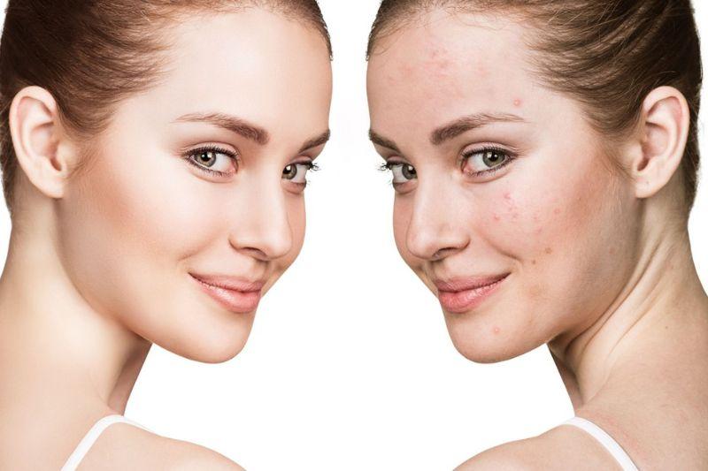 plasmoterapia-tm-aesthetic-medical-center