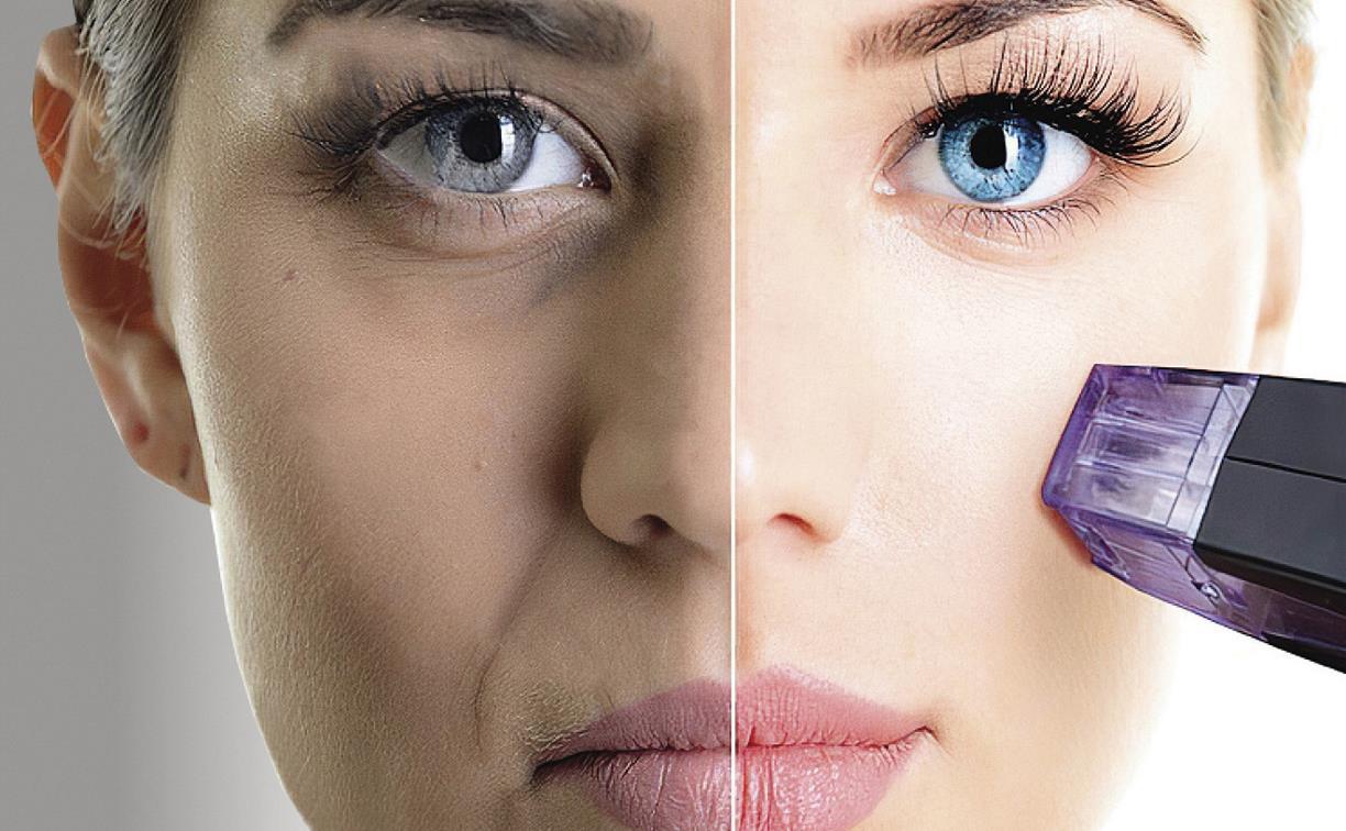 rf-lifting-morpheus-line-beauty-salon