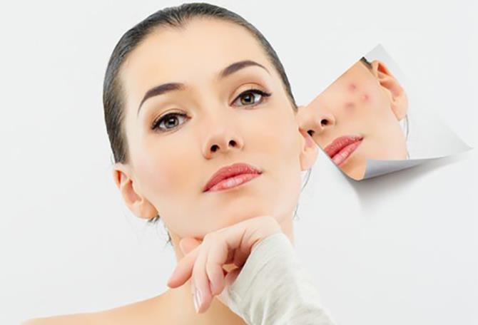 pigmentneri-erakneri-lazerayin-bujum-eritasardacum-sona-salon