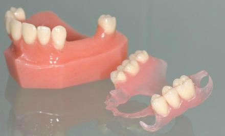 silicone-protesner-nor-jpit-dental-center