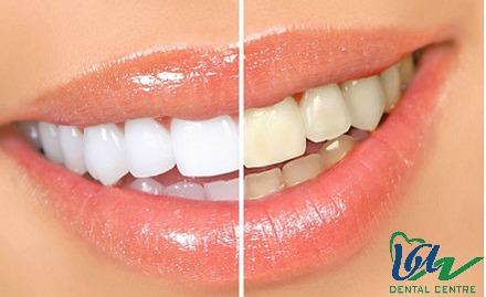 air-flow-van-dental-centre