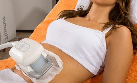 skinology-yerevan-cryolipolysis-cavitation